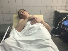 Избитый волонтер штаба Навального Александр Туровский. Фото: twitter.com/serukanov_v
