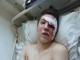 Башир Хамхоев попал под следствие с больничной койки. Фото: NewsBoy.Ru 
